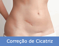 correcao de cicatriz