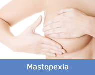 mastopexia